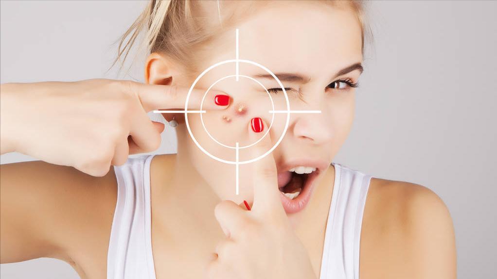 脸上长痘化脓有什么好办法,脸上化脓的痘痘去除最快方法