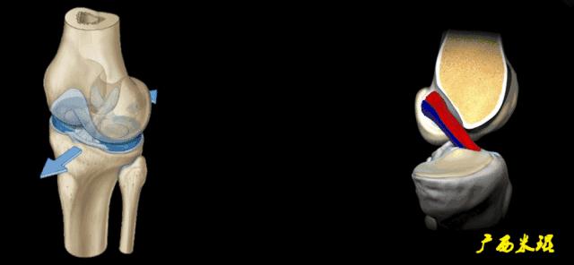 膝盖扭伤前交叉韧带损伤可以热敷,前交叉韧带扭伤最快自愈方法