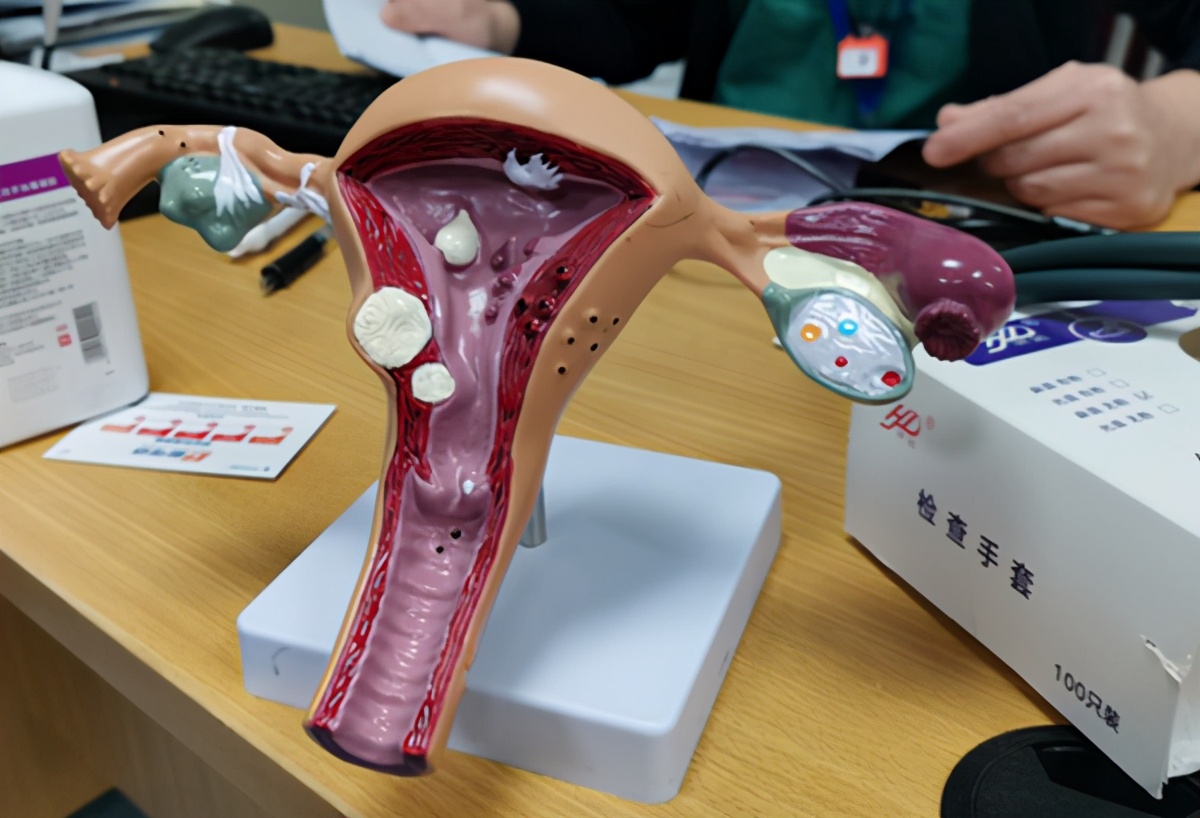 摆脱重度痛经，一定要切子宫？不，“一根针”微创治疗能保宫去痛