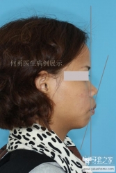 正畸医生如何指定方案的,正畸医生怎么说