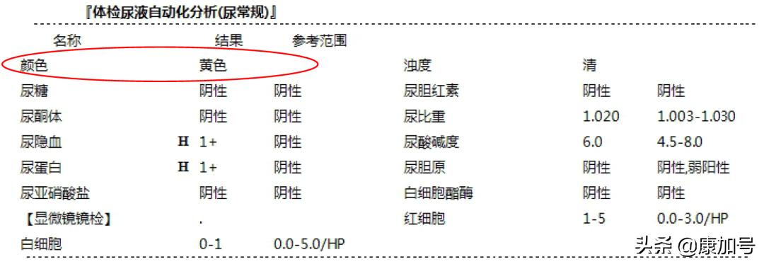 读懂体检单丨尿常规检查，能看出来肾好不好？一文教你看懂