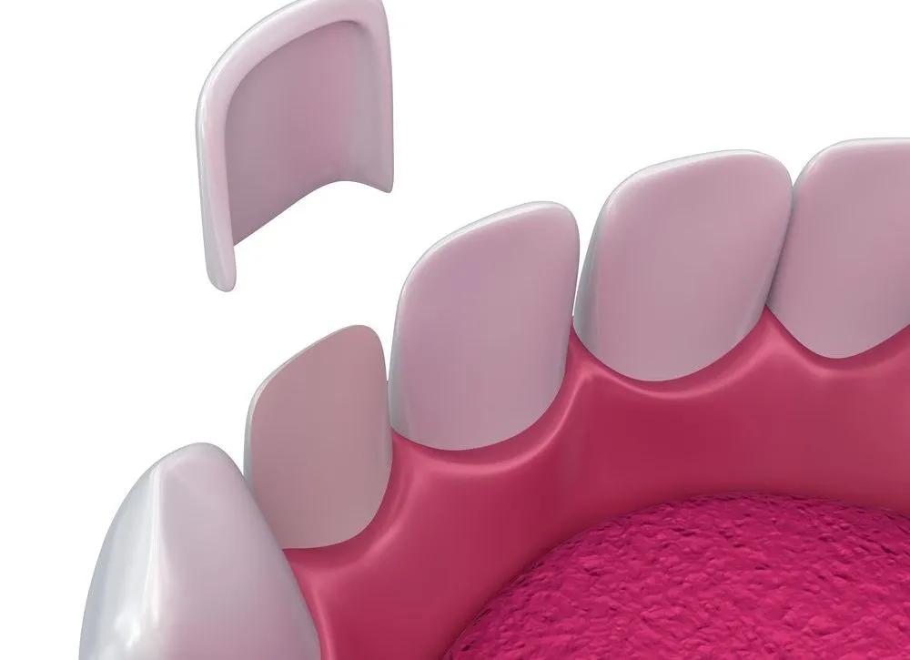 如何让牙齿变白去除黄渍牙膏推荐,口臭和牙黄用什么牙膏让牙齿变白