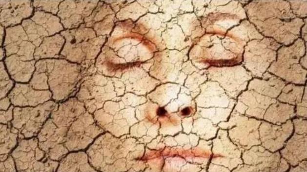 长期贴胶布皮肤干裂起皮,脚后跟皮肤干裂起皮怎么办