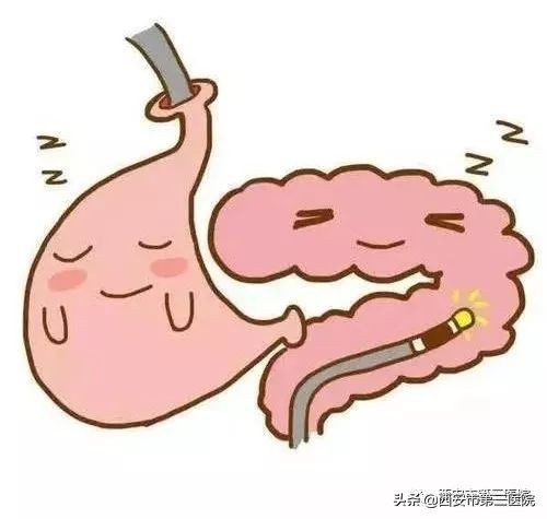 专家医生讲胆囊息肉,息肉是否越切长得越快