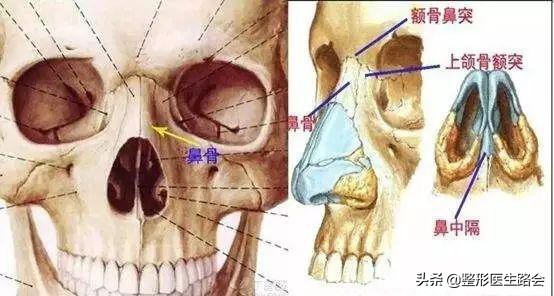 不做手术提高鼻梁的方法,不做手术鼻梁增高方法