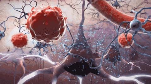 脐带血真的可以治帕金森,脐带血真的可以救命么