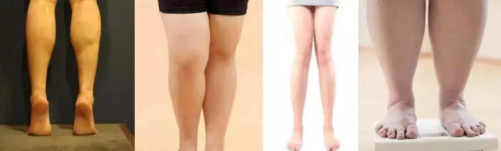 娱乐时尚圈的宠儿：法国发热裤，这个冬天，做个不怕冷的腿精