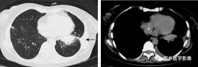肺部基础免疫,肺基础疾病有哪些