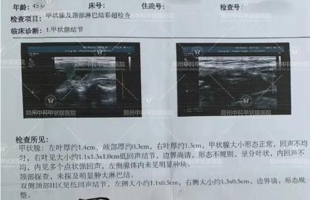 为什么肿瘤患者都拒绝做穿刺活检,穿刺活检恶性还能手术吗