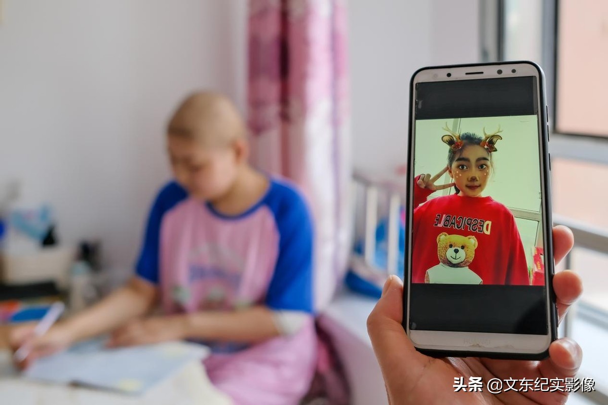 大头娃娃目前能治好吗,大头娃娃患病的原因是