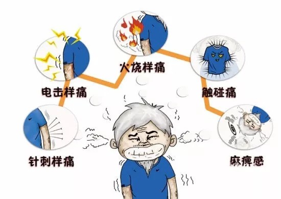 带状疱疹为什么痛不欲生,让人疼痛难忍的带状疱疹