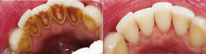 濂冲＋鍙ｈ厰棣欐按鎸佷箙鐣欓,濂介椈鍙ｈ厰鍠烽浘棣欐按