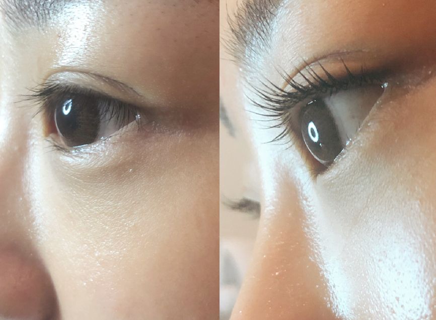 每周一次精准有效的皮肤管理,选对护肤方法让你做靓丽女神