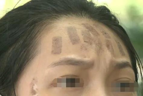 广西女子毁容后续,一妇女惨遭毁容