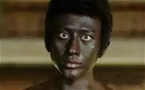 欣奕除疤凝胶对疤痕体质有效果吗,疤痕形成后用芦荟能除疤吗