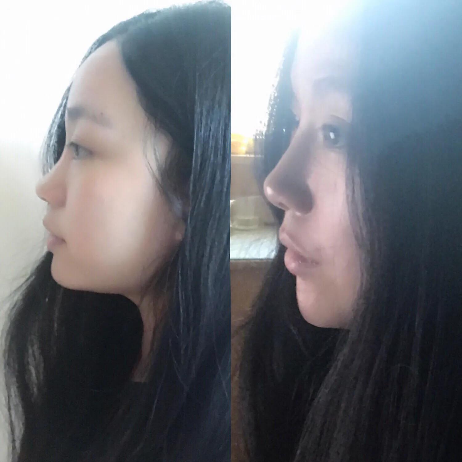 高鼻梁养成记✌️你不得不知道的变美秘密