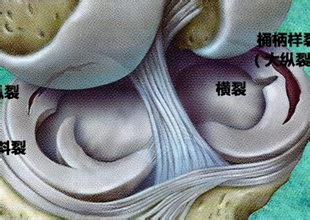 谈“骨”论“筋”|膝盖又疼了？来教你几个康复锻炼方法