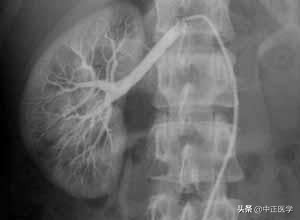 造影检查有必要做吗,输卵管造影前做什么检查项目