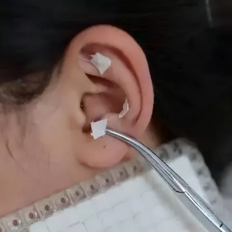 中医喊你来治疗慢性盆腔炎，多的是你不知道的优势