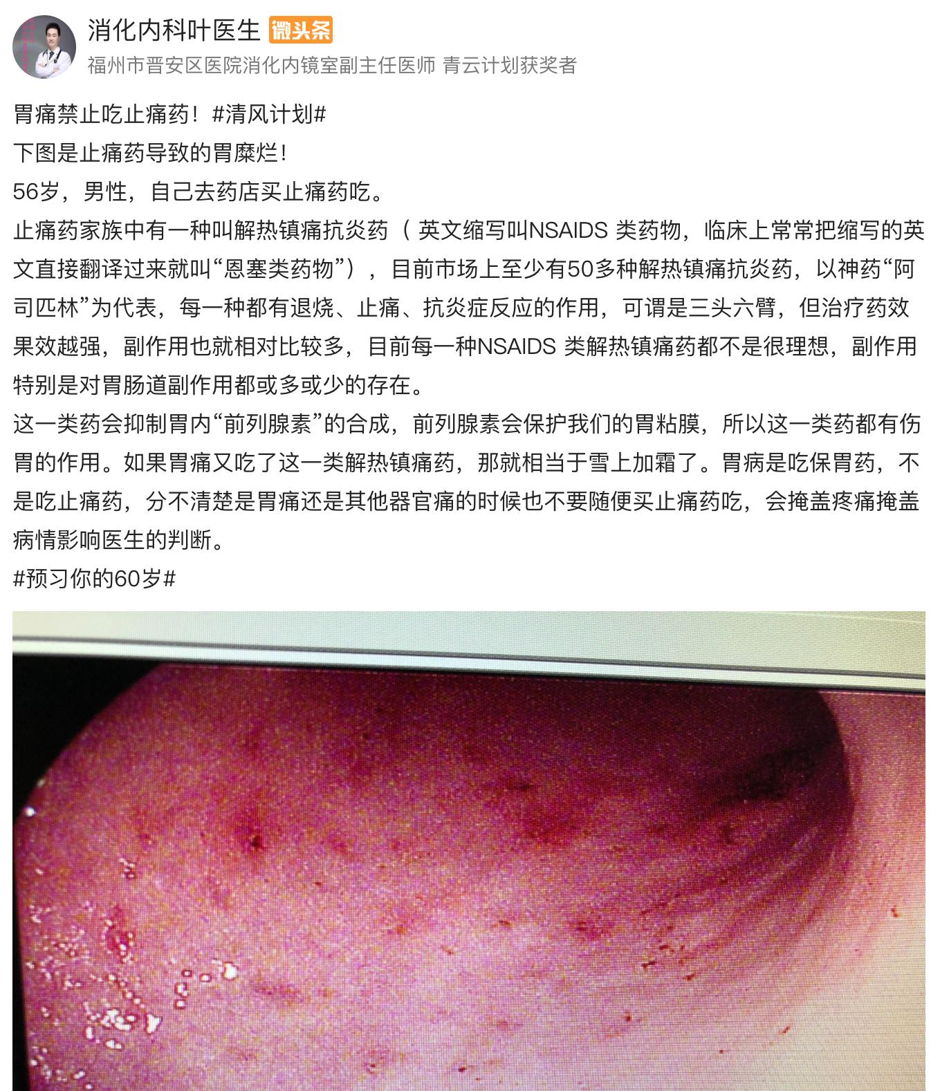 胃为什么吃得太饱就反酸顶气,胃为啥消化那么快