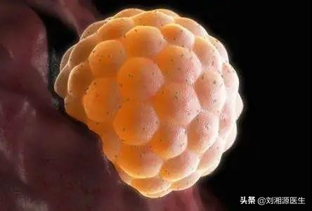 怀孕如何避免强直性脊柱炎,免疫修复治强直性脊柱炎