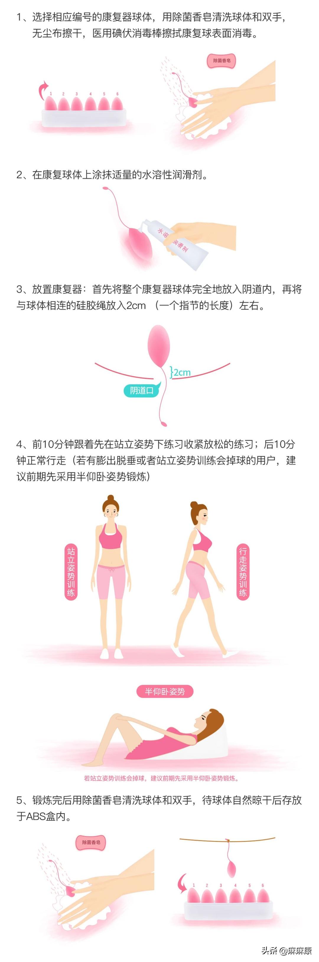 这3种盆底肌修复锻炼的方式有何不同？