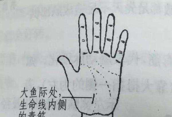 手背青筋明显是血管硬化的表现吗,血管有问题看哪个科