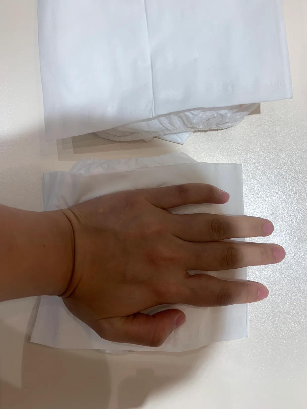 什么纸尿裤不过敏,明治纸尿裤过敏