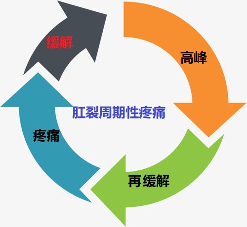 肛肠科专家肛裂,肛肠科医生怎么判断肛裂