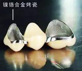 牙齿折断根部怎么弄出来,牙齿断了医生说先观察一段时间