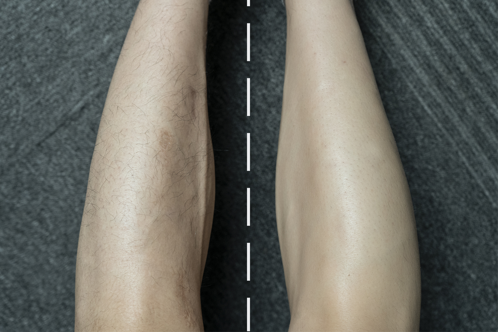 小米剃毛器男士专用,小米除体毛器电动