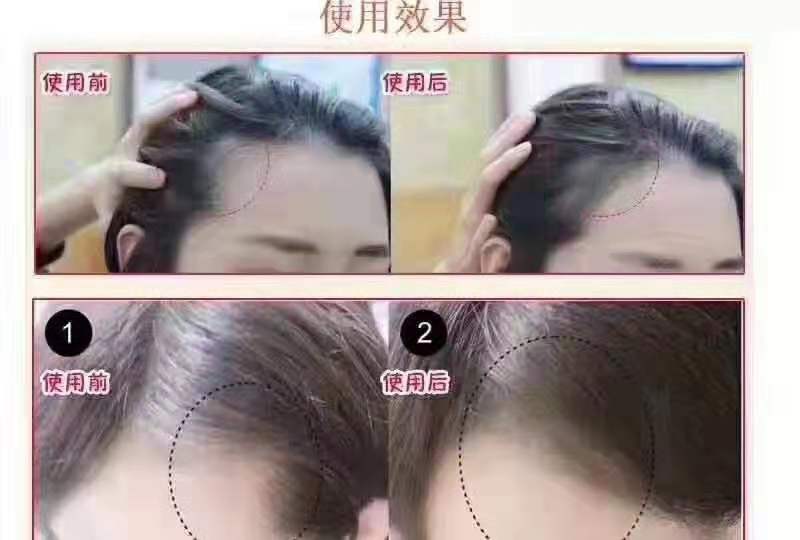 那些非常实用的护肤小东西你都知道吗？