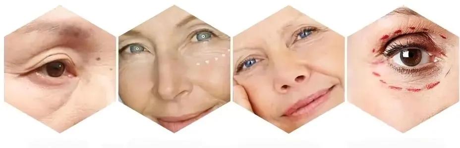 脸上长皱纹的原因是什么怎么改善,脸上都出现皱纹了怎样延缓衰老