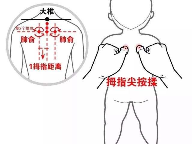 儿童哮喘成人哮喘,儿童哮喘发病率有多高