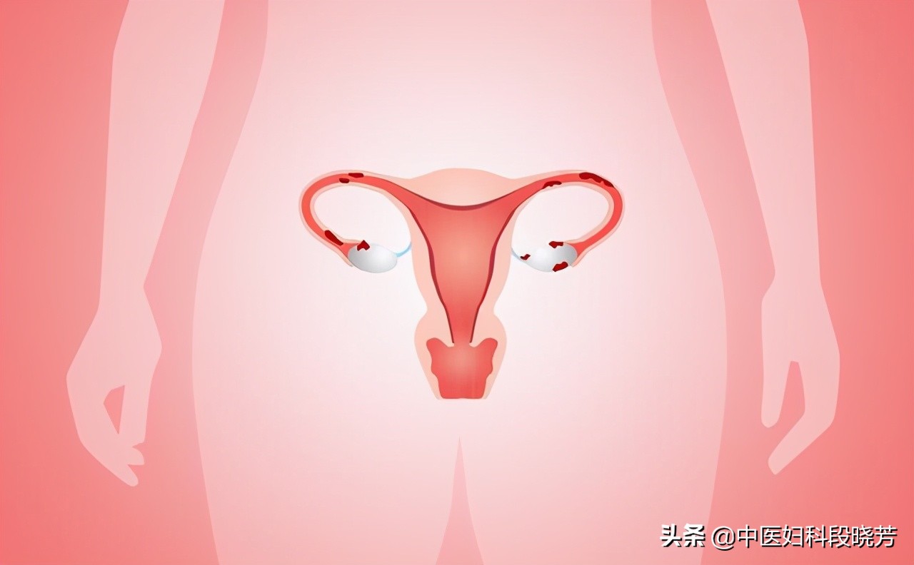 卵巢早衰的症状会让人衰老吗,卵巢早衰的8大征兆怎么治疗