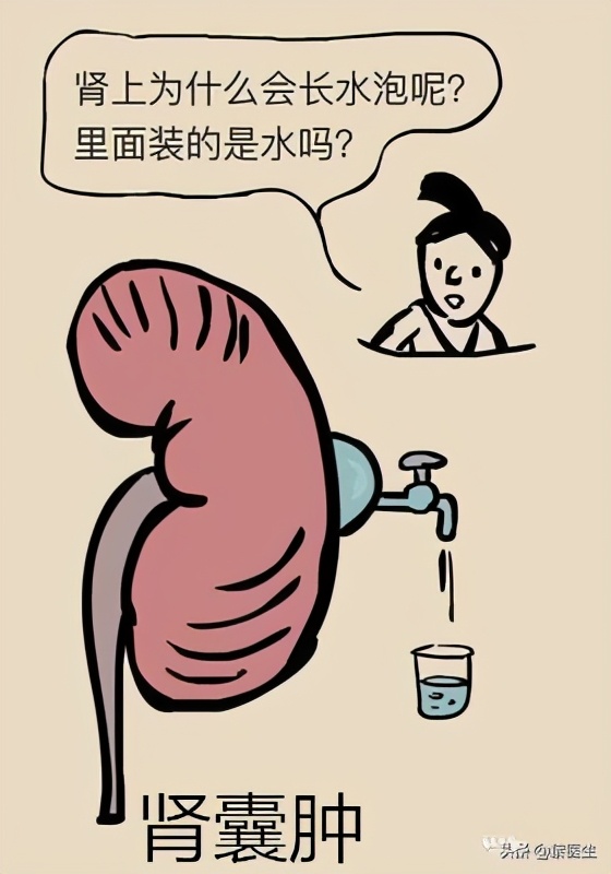 全身有结节囊肿息肉能治愈吗,宫颈囊肿息肉会癌变吗