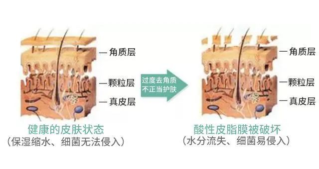 角质层比较薄的皮肤怎么保养,皮肤角质层薄大红脸用什么产品