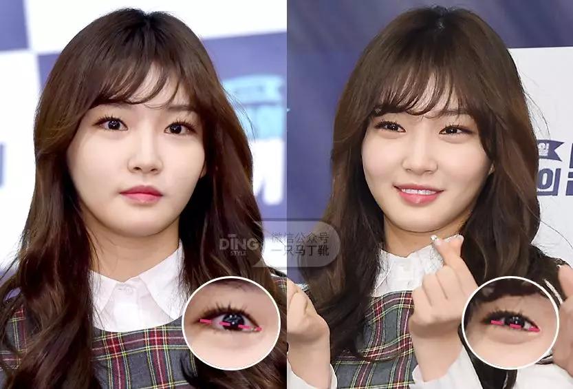 娜扎请夏获奖视频,娜扎领奖春夏