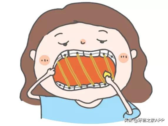 疫情时牙套遇到突发情况怎么办？应对办法在这里