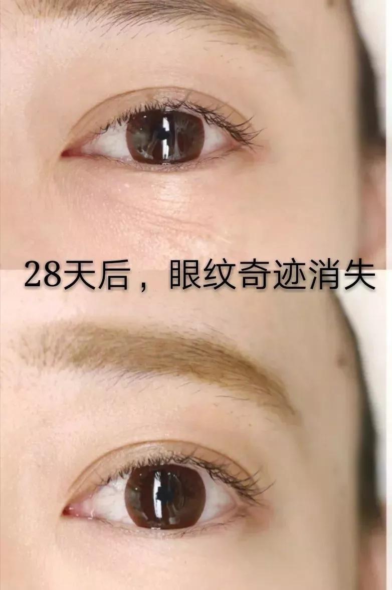 刘亦菲保养皮肤的方法,30岁皱纹多怎么修复