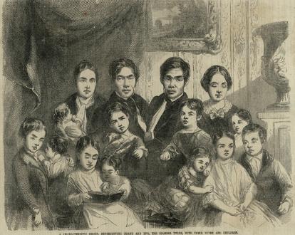 爱因斯坦的大脑解剖全过程,爱因斯坦的大脑为科学奉献一生