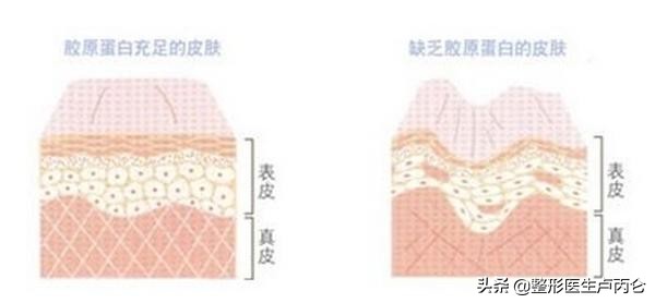 微整形玻尿酸操作流程 (玻尿酸微整形是哪个国家兴起的)