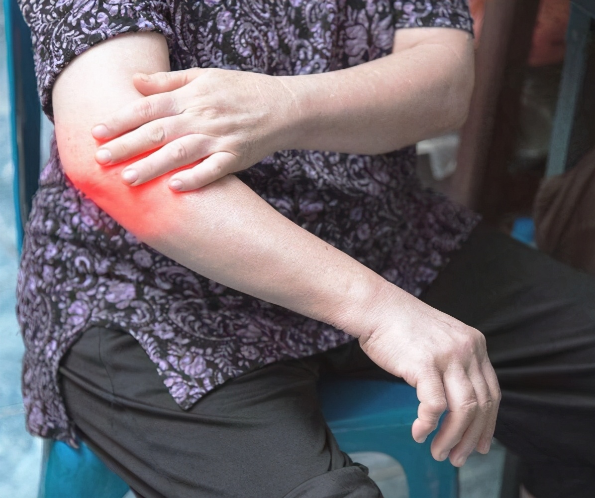 痛风关节红肿疼痛到底该怎么办呢,痛风发作关节红肿在家用什么偏方