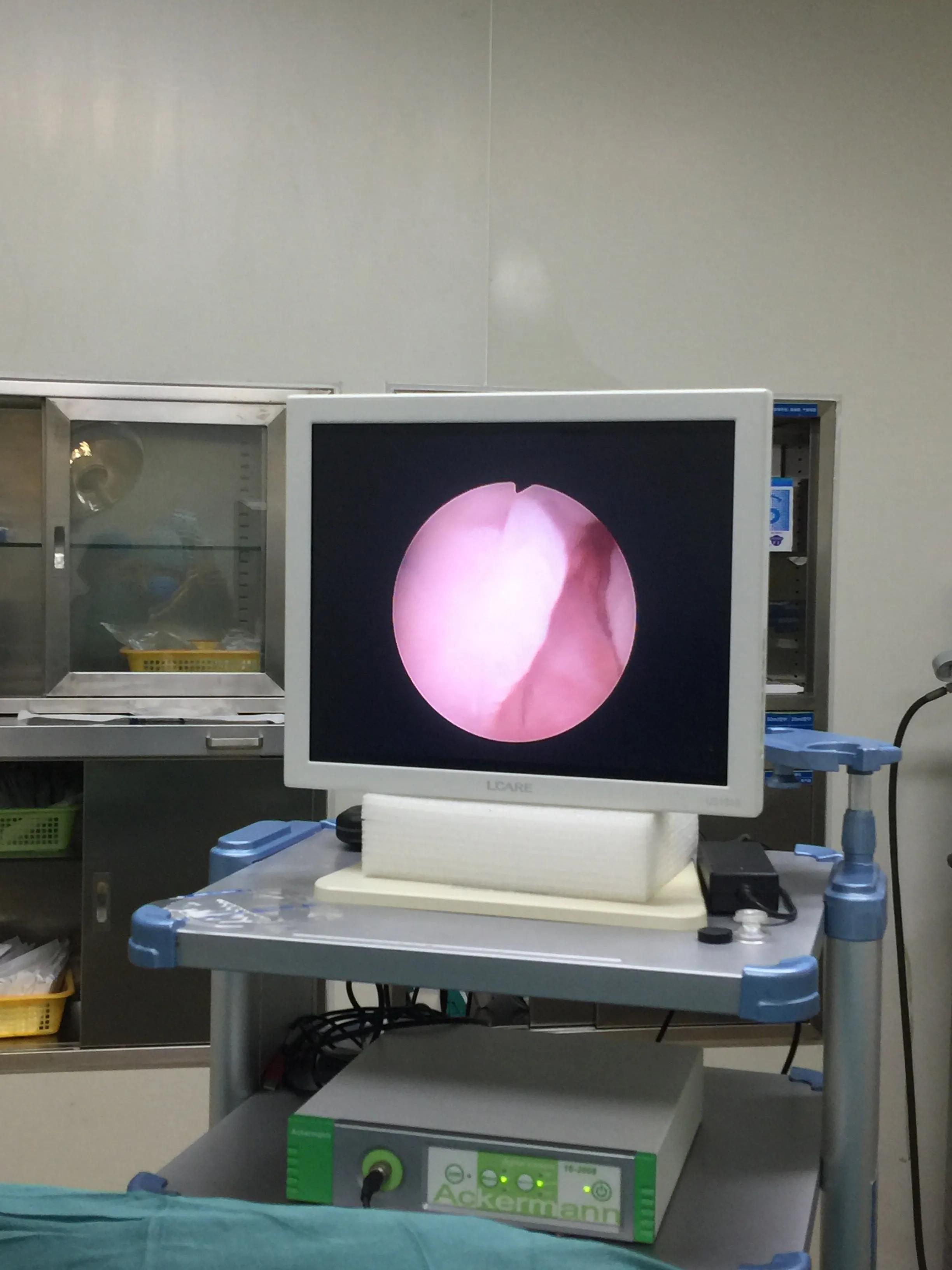 女病人尿不出怎么办,女病人排不出尿最快方法