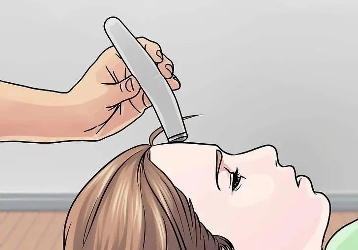 点阵激光治疗凹陷疤痕恢复过程,痤疮疤痕疙瘩可以激光治疗吗