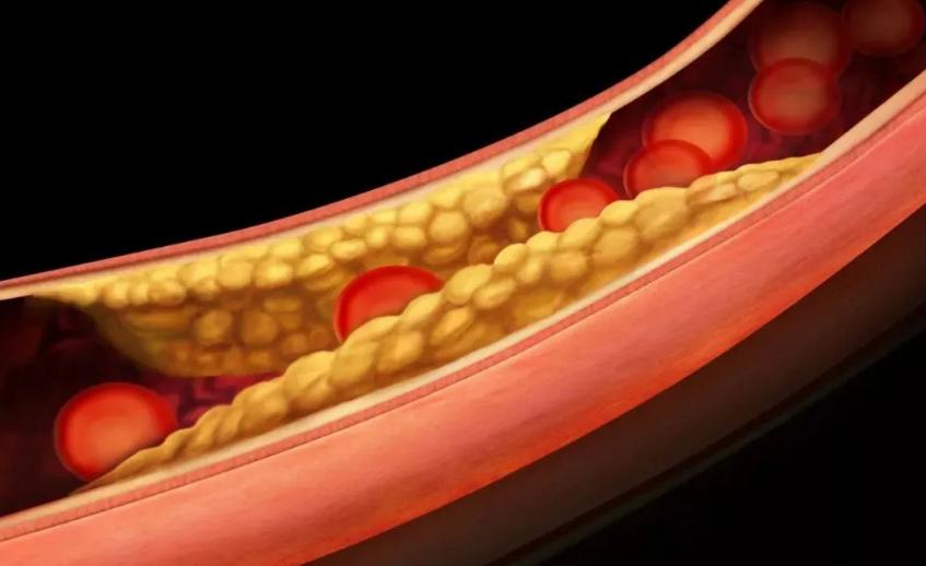股骨头疼膝盖疼是咋回事,股骨头坏死膝盖疼是病情加重吗