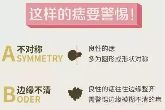 宝宝怎么越长越嫩,宝宝长了一个不规则的痣