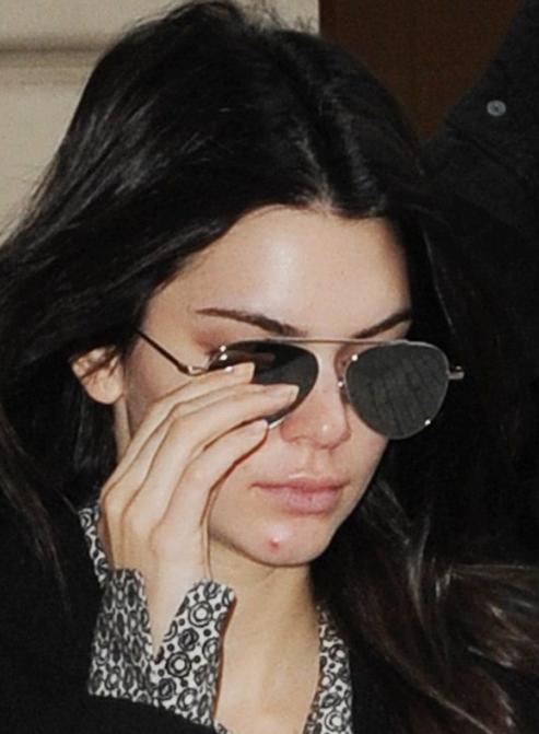 痘痘好多了脸一直红,痘痘反复没完没了