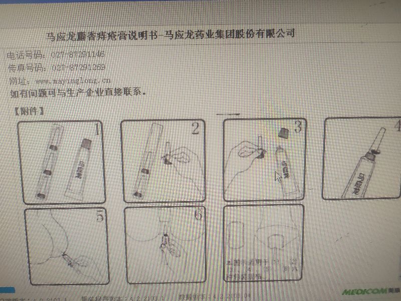 双氯芬酸钠栓塞鼻孔，马应龙痔疮膏注入器纳肛，临床错误用法盘点