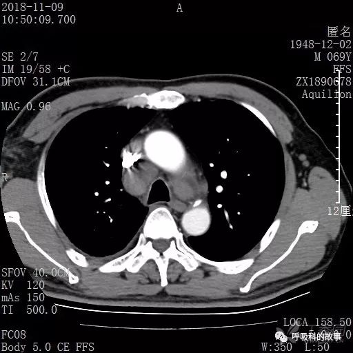 怎么应用统计学做调查,统计学方法可以解决的主要问题